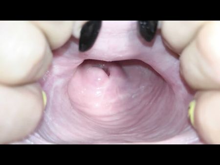 Cervix Close Up 