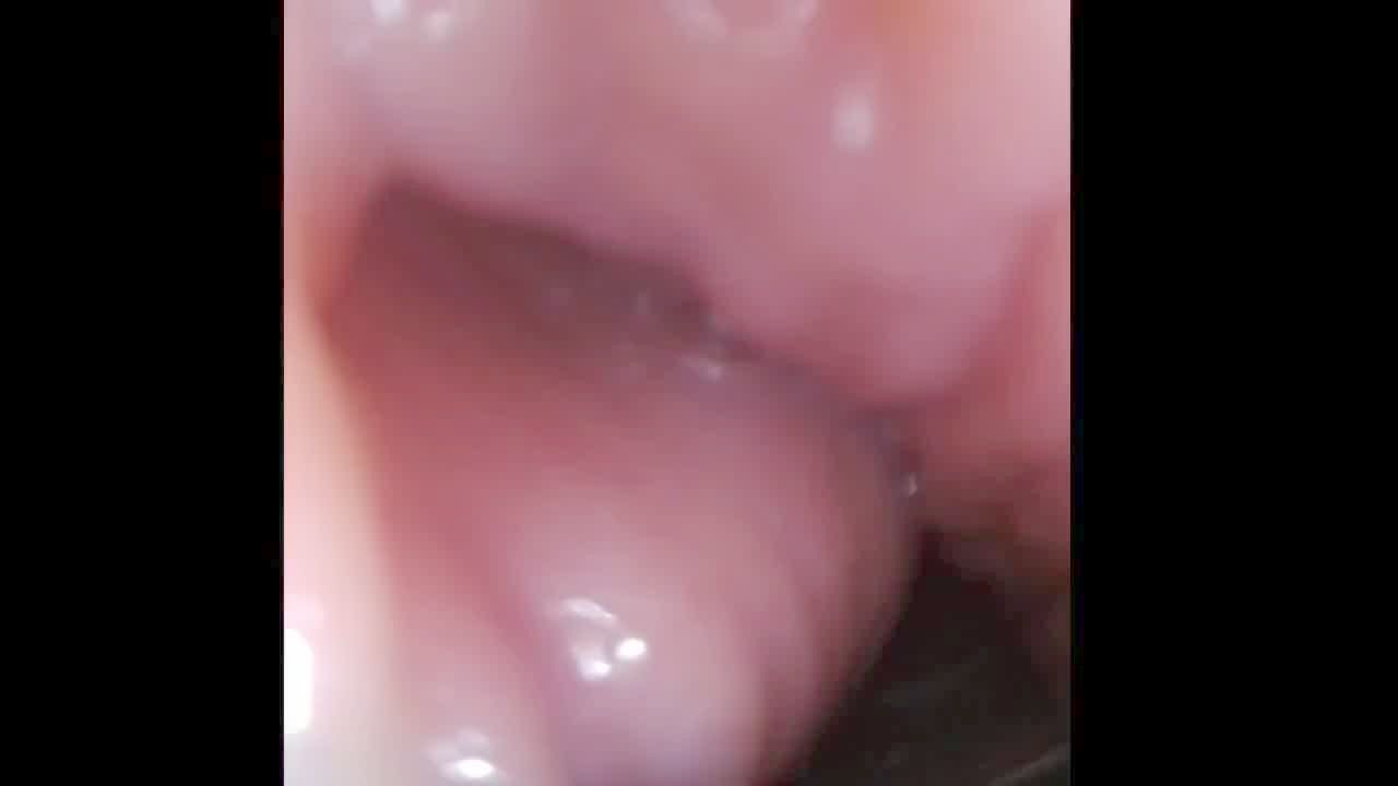 Vista Interna Da Vagina Do Colo Do útero Cumming Dentro Da Buceta