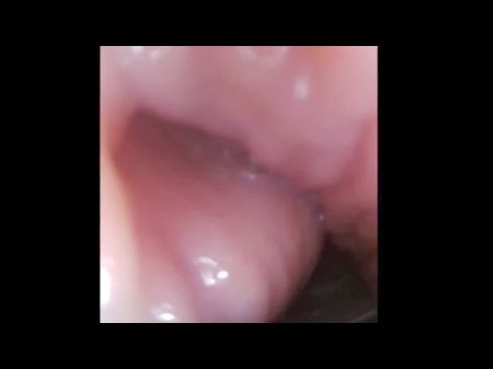 Inwards View Of Twat From Cervix Nutting Inwards Labia