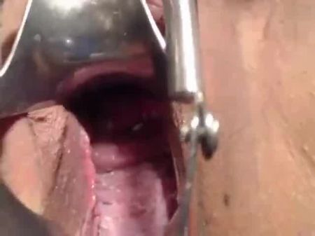 Speculum Show And Rub My Cervix Close Up: Free Porn A9