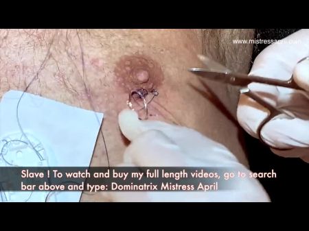 Medical Chastation: Free German Hd Porn Vid 3e -