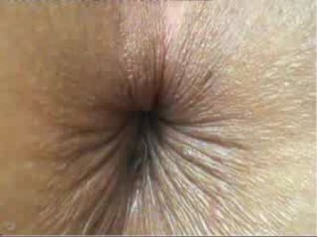 Close Up Butt Hole Blinking