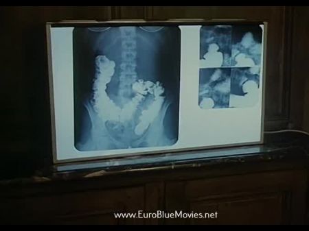 RX para Sex 1980 