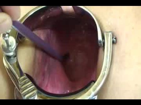 Elmers Frau Extreme Speclum Anal gape kak1 