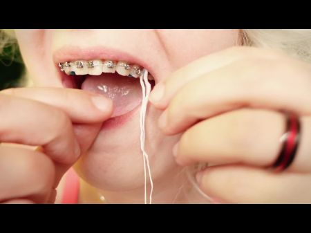 اليوم الثاني في أقواس الأسنان خيط عن قرب جولة الفم 