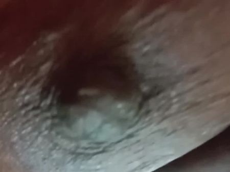 I Witnessed My Wife Open Up The Wound And He Groped His Finger And Washed It Away