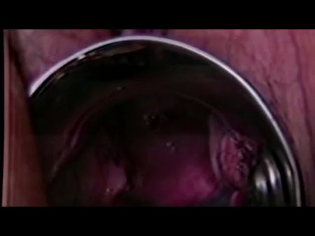 Zervikaler Orgasmus im Detail 