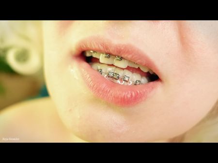 Braces Facehole Excursion Flick - Vore Addiction