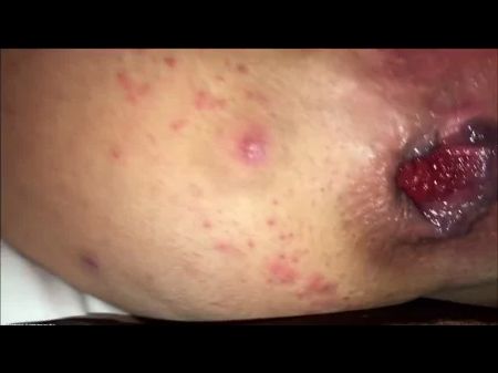 Fledgling Couple , Awful Buttfuck Rosebud Licking