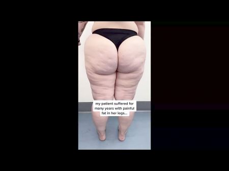 Broad Thighs And Ginormous Delicious Butts - A Anthology Part 1