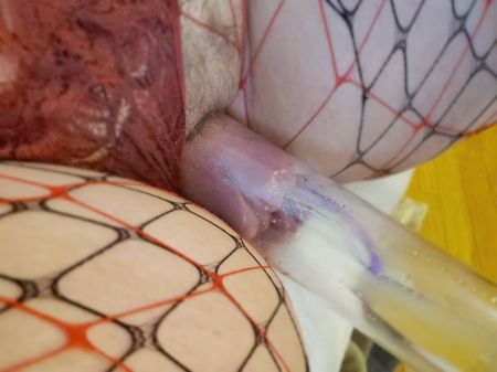 Mistress Gina Pumps Out Inside Pussy Pump , Massive Bean And Lips