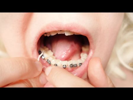 2nd Day In Braces - Dental Floss - Close Up Facehole Excursion