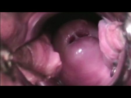 Cervikal Ejaculation In Detail